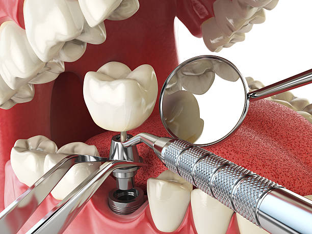 Best Emergency Treatment for Jaw Pain or Injury in La Quinta, CA
